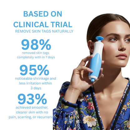 TagZap- Skin Tag Removal Kit