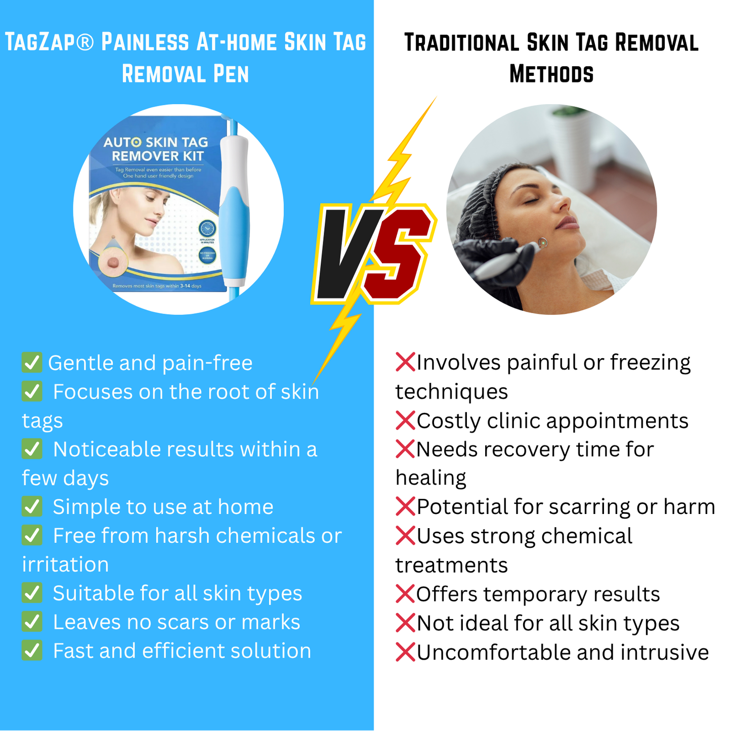 TagZap- Skin Tag Removal Kit
