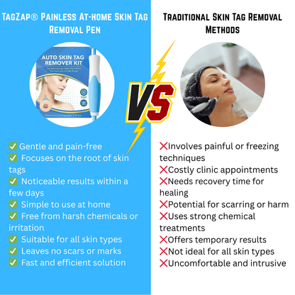 TagZap- Skin Tag Removal Kit