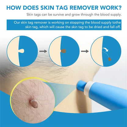 2 in 1 Auto Micro Skin Tag Remover Device Standard and Micro Skin Tag Removal Kit Adult Mole Wart Remover Face Care Beauty Tools